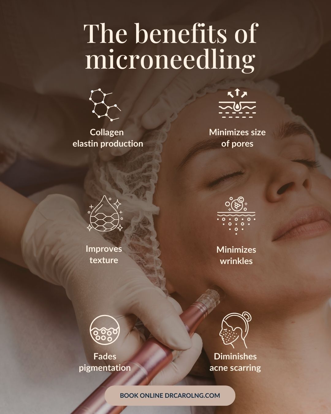 The benefits of microneedling
